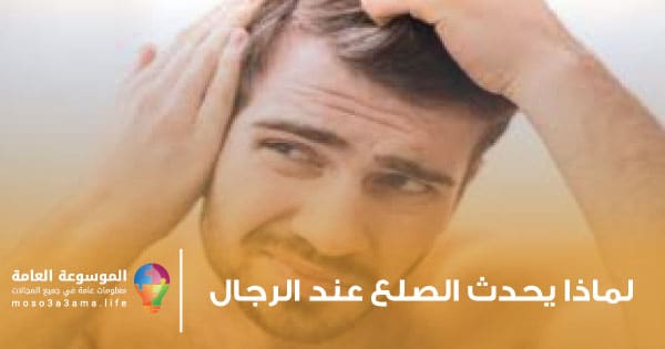 لماذا يحدث الصلع عند الرجال