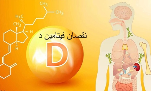 نقصان فيتامين د
